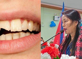 जेष्ठ नागरिकको दाँत रामधुनी नगरपालिकाले बनाइदिने, १० लाख बजेट विनियोजन